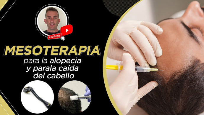 Mesoterapia para la alopecia androgénica (calvicie común) ¿Interesa?