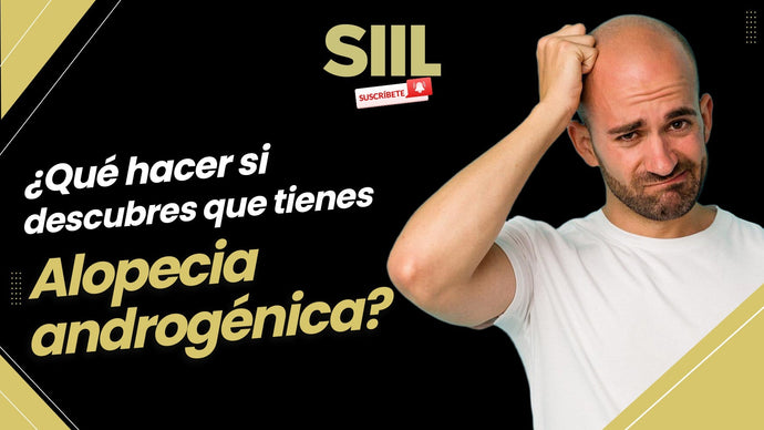 Qué hacer si descubres que tienes Alopecia Androgénica. Qué debes saber si ya has empezado a notar la caída